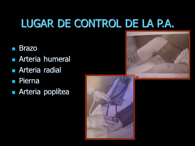 LUGAR DE CONTROL DE LA P.A. Brazo Arteria humeral Arteria radial Pierna Arteria poplítea